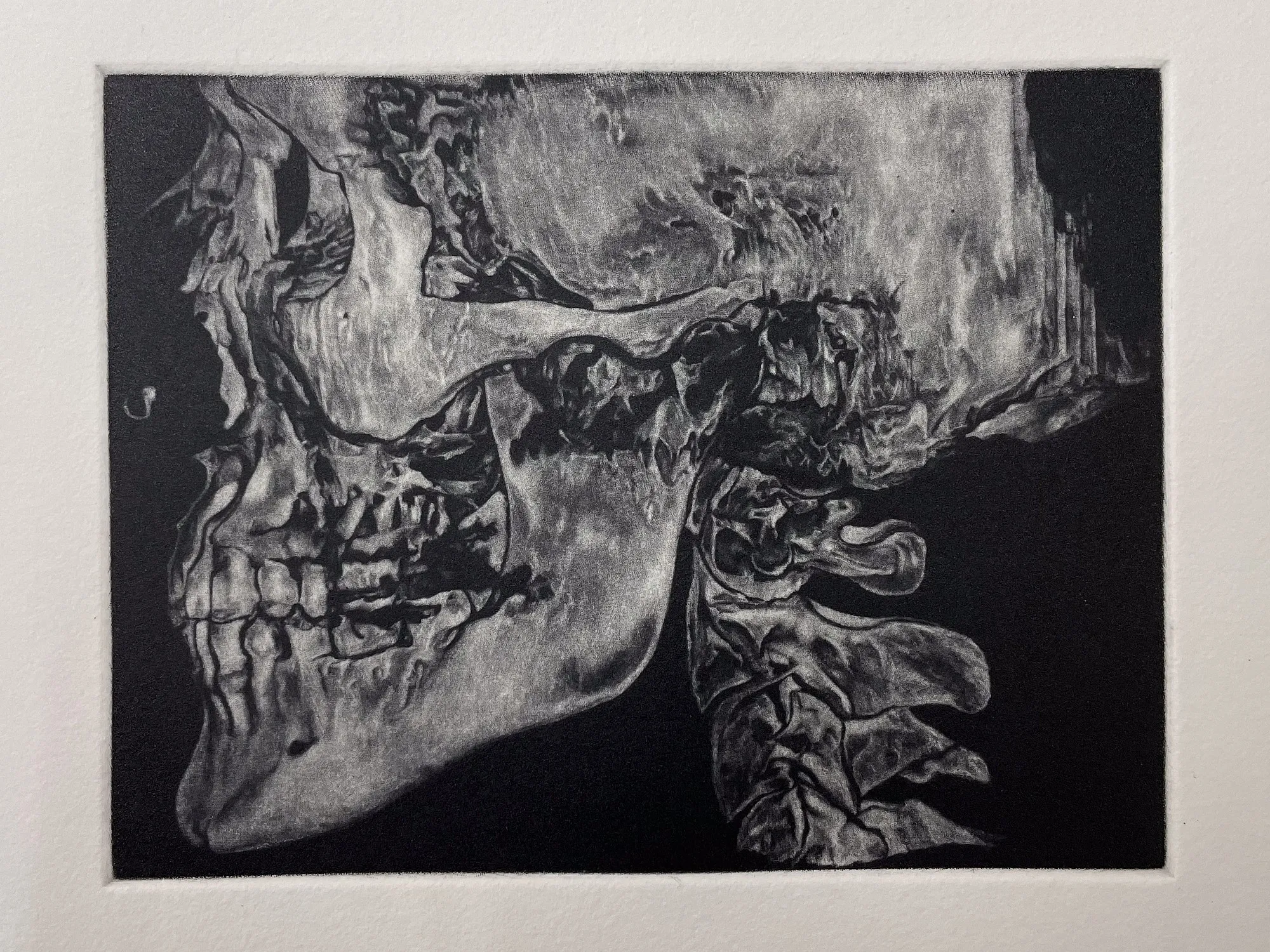 Close detail of the first state: a skull in profile against a dense black ground, with fine tonal gradation across the bone and sharp separation between the skull and the background.