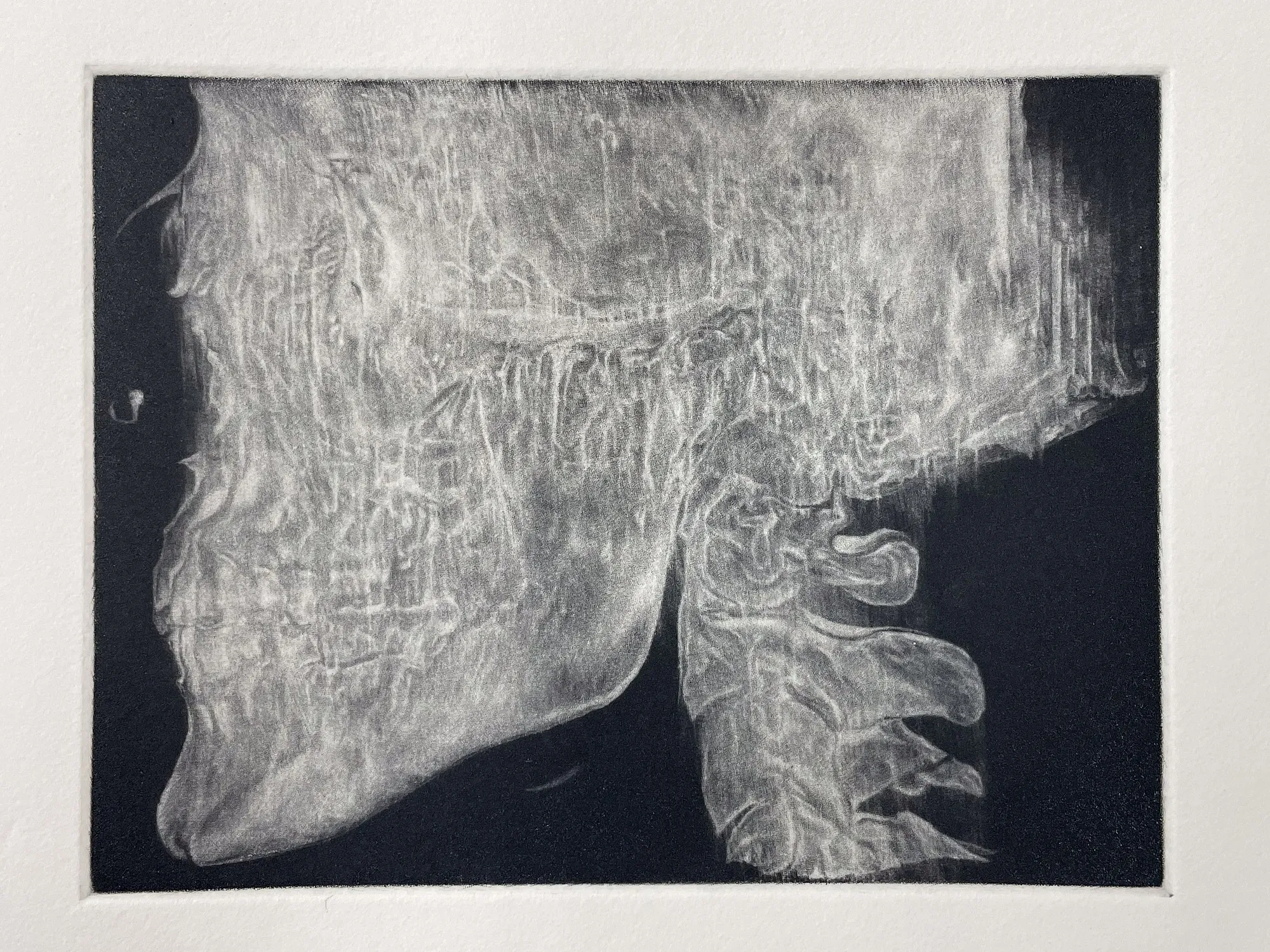 Close detail of the ninth state: the same skull, now pale and flattened, its internal detail largely gone, so that it no longer separates cleanly from a ground that remains dark.