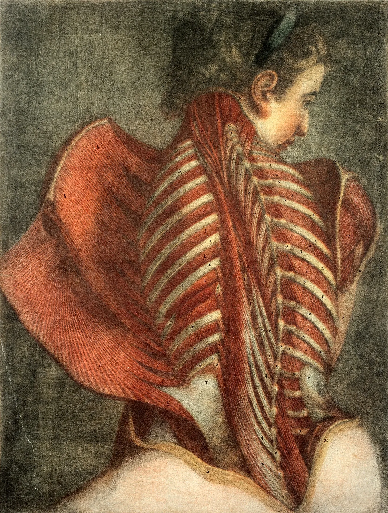 A colour mezzotint of a seated woman seen from behind, the skin of her back and shoulder dissected away to reveal the muscles, which open outward on either side of the spine like a pair of wings.