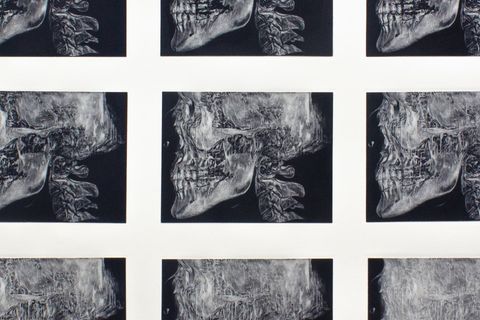 Mezzotint